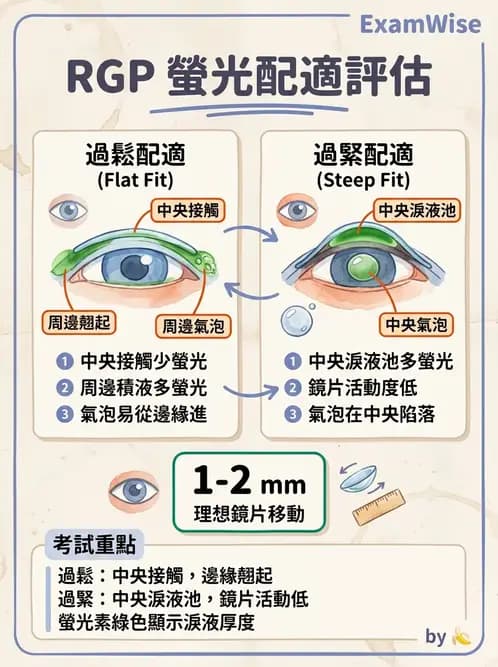 驗光生 - 硬式隱形眼鏡螢光染色評估與特殊臨床適應症 - AI 圖文解析預覽