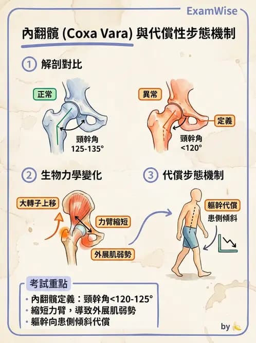物治 - 異常步態與姿勢分析 - AI 圖文解析預覽