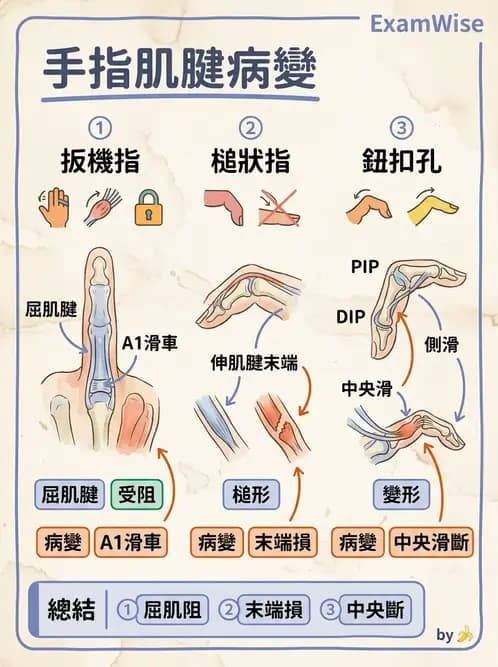 物治 - 手部肌腱損傷與變形 - AI 圖文解析預覽