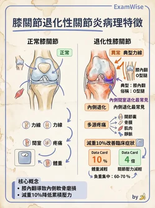 物治 - 膝關節生物力學與退化性疾病 - AI 圖文解析預覽