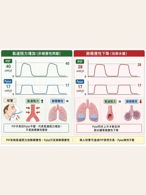 呼吸治療師 - 呼吸器圖形判讀與故障排除 - AI 圖文解析預覽