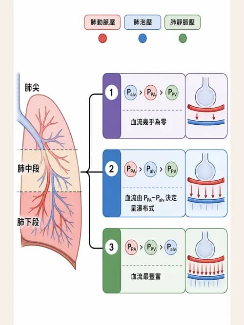 呼吸治療師 - 重症監測與判讀 - AI 圖文解析預覽