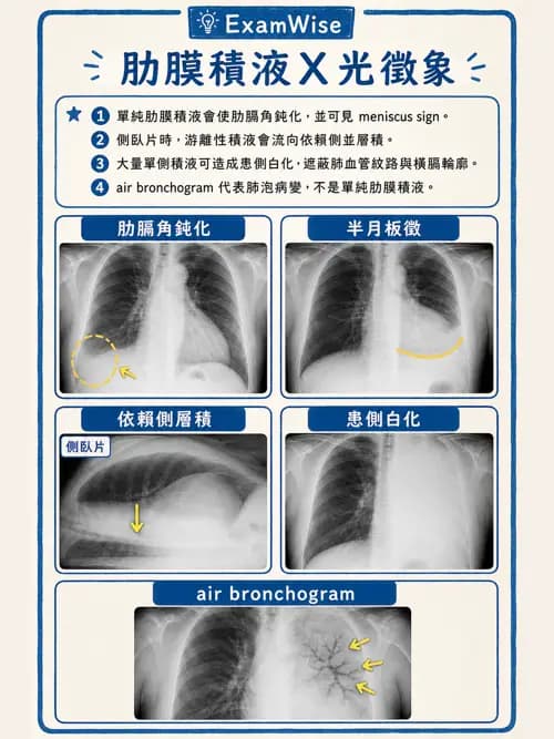 呼吸治療師 - 外力傷害與胸廓病變 - AI 圖文解析預覽