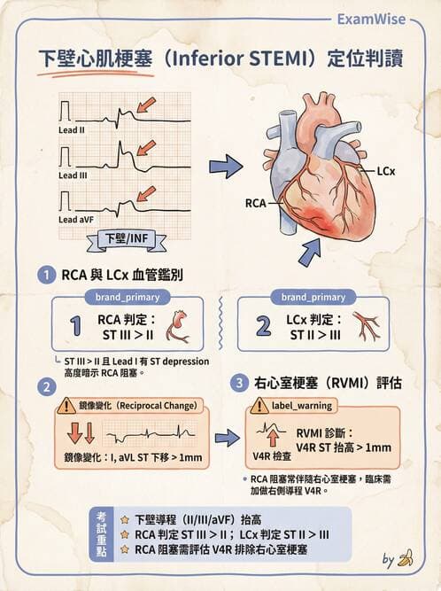 內專 - 急性冠心症 - AI 圖文解析預覽