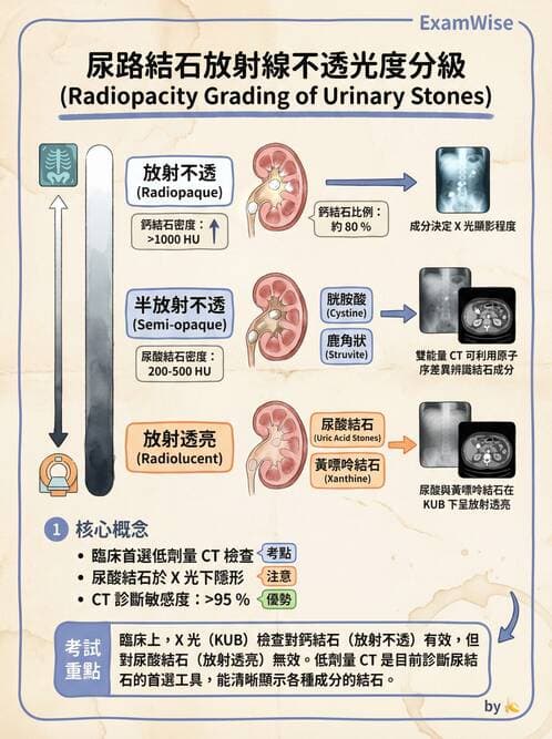 專師 - 泌尿道結石 - AI 圖文解析預覽