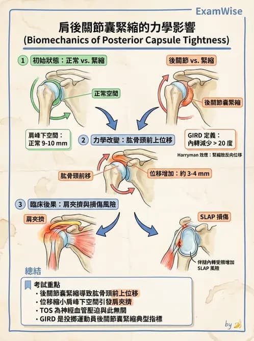 物治 - 冰凍肩與胸廓出口症候群 - AI 圖文解析預覽