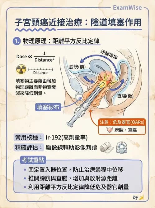 放射 - 腔內近接治療 - AI 圖文解析預覽