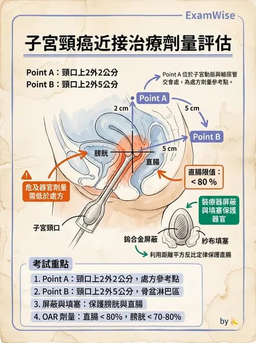 放射 - 腔內近接治療 - AI 圖文解析預覽