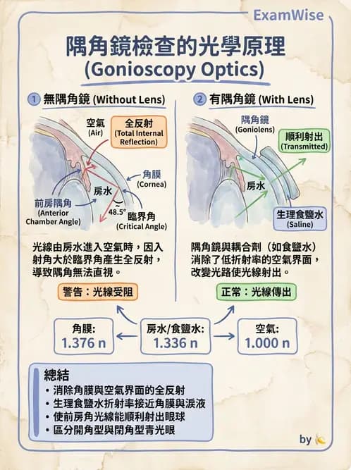 驗光師 - 折射定律、反射與光學現象 - AI 圖文解析預覽
