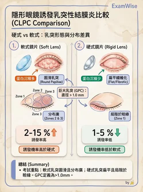 驗光師 - 結膜眼瞼反應、沉澱物與乾眼 - AI 圖文解析預覽