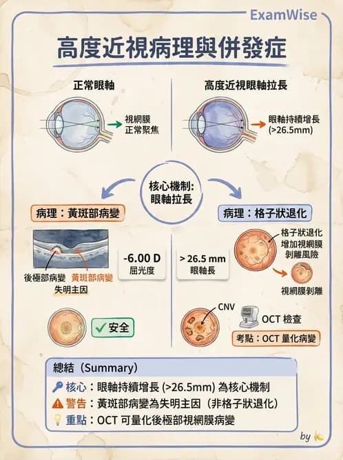 驗光師 - 近視併發症 - AI 圖文解析預覽