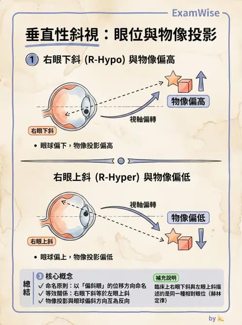 驗光師 - 斜視 - AI 圖文解析預覽