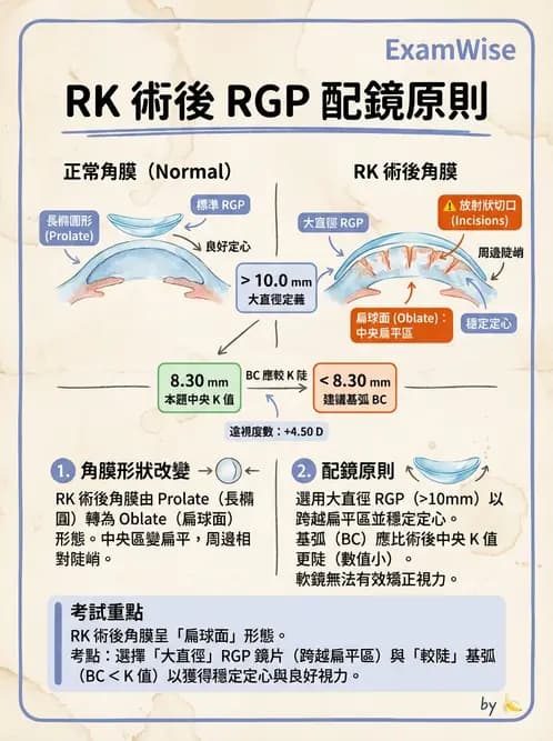 驗光師 - 特殊隱形眼鏡驗配 - AI 圖文解析預覽