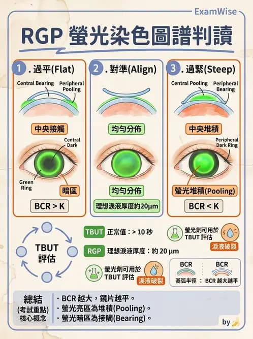 驗光生 - 硬式隱形眼鏡螢光染色評估與特殊臨床適應症 - AI 圖文解析預覽