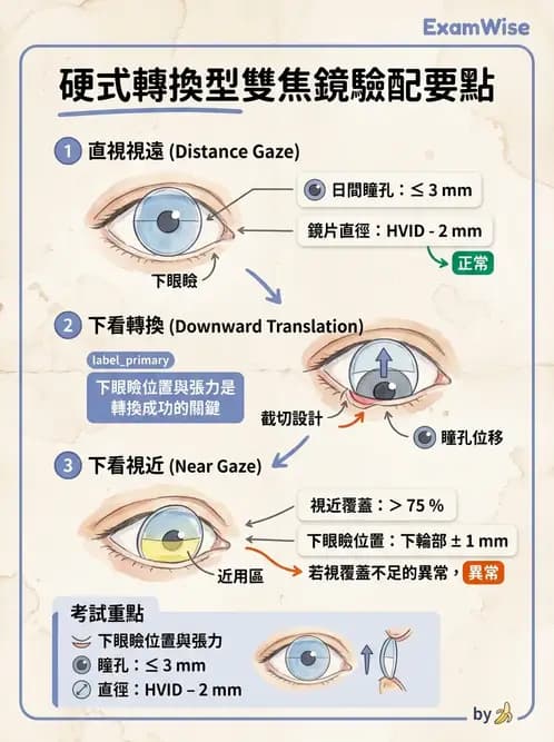 驗光師 - 老花隱形眼鏡驗配 - AI 圖文解析預覽