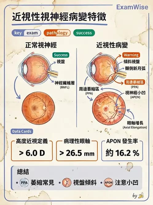 驗光師 - 近視併發症 - AI 圖文解析預覽