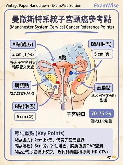 放射 - 腔內近接治療 - AI 圖文解析預覽
