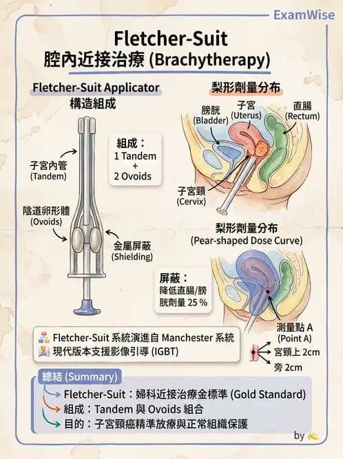 放射 - 腔內近接治療 - AI 圖文解析預覽
