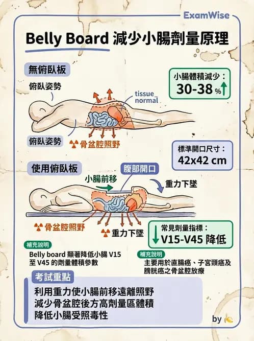 放射 - 模具製作 - AI 圖文解析預覽