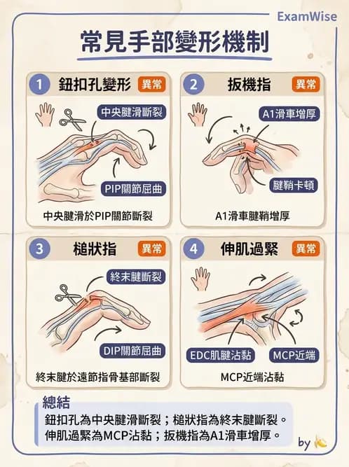 物治 - 手部肌腱損傷與變形 - AI 圖文解析預覽