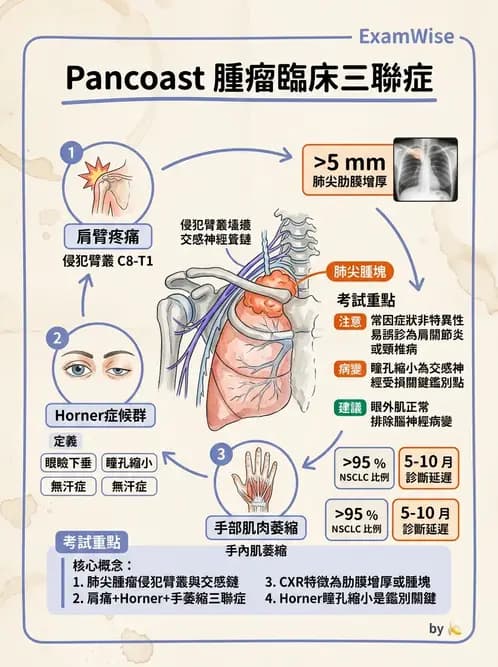 內專 - 肺癌 - AI 圖文解析預覽