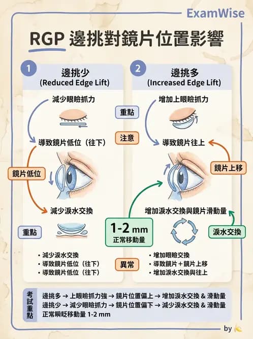 驗光師 - 隱形眼鏡設計 - AI 圖文解析預覽