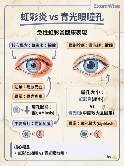 驗光師 - 葡萄膜炎與免疫相關眼病變 - AI 圖文解析預覽