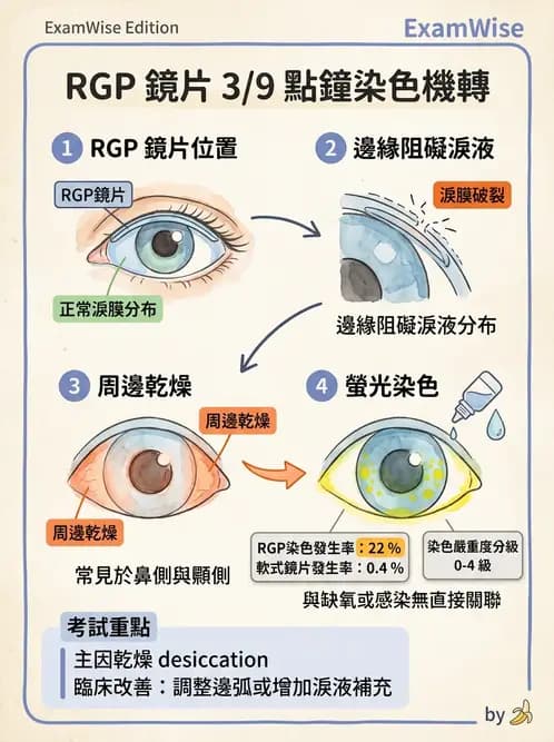 驗光生 - 硬式隱形眼鏡螢光染色評估與特殊臨床適應症 - AI 圖文解析預覽